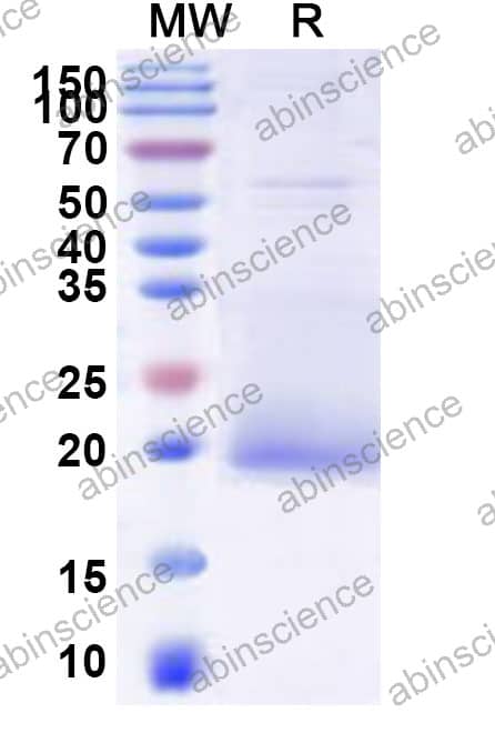 Recombinant HPV31 E7 Protein, C-His