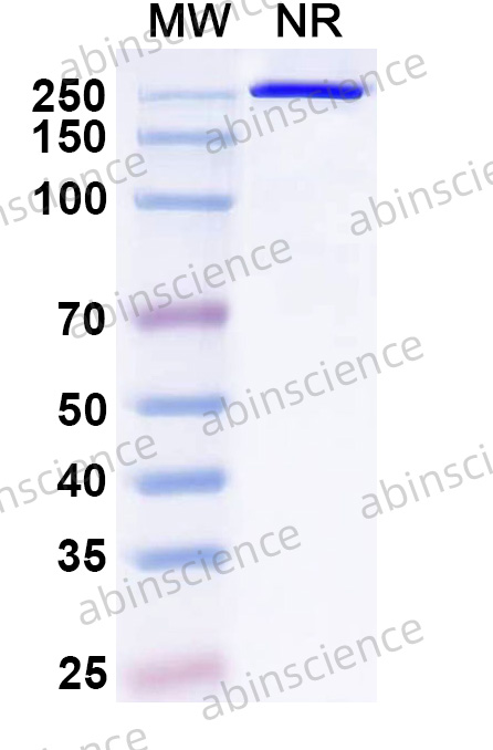 Anti-Hantaan virus/HTNV Glycoprotein N/Gn Antibody (AH100)