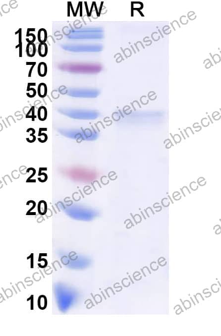 Recombinant ASFV CP2475L (p37) Protein, N-His