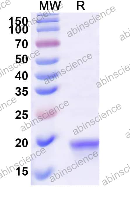 Recombinant ASFV CP2475L (p14) Protein, N-His