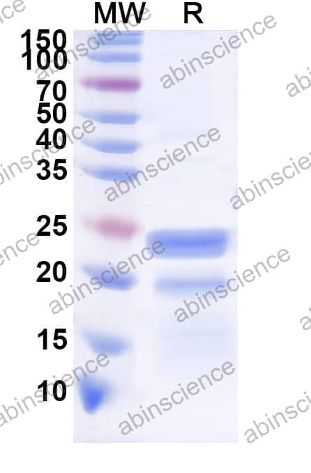 Recombinant ASFV Q706L Protein, N-His