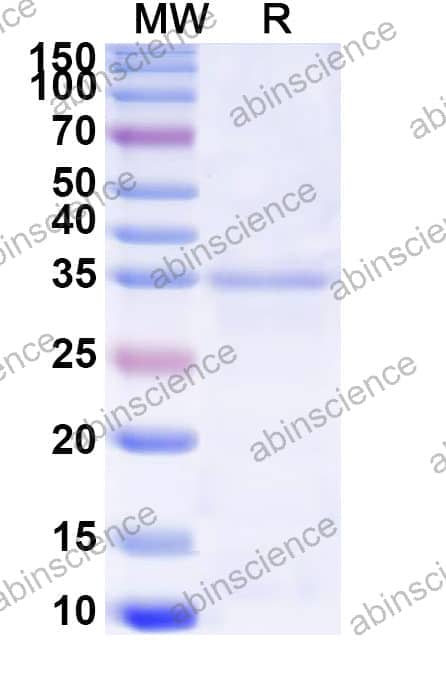Recombinant ASFV NP868R Protein, N-His