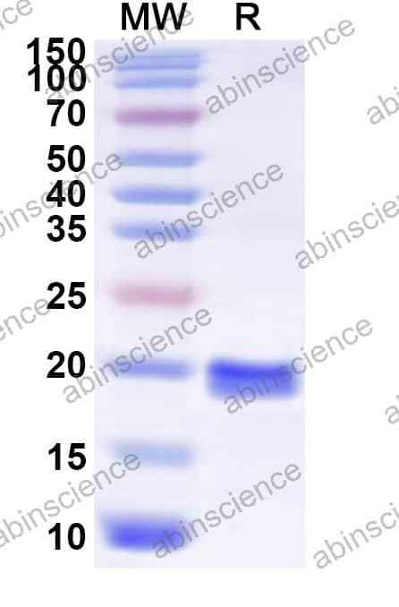 Recombinant MACV Glycoprotein G1, N-His