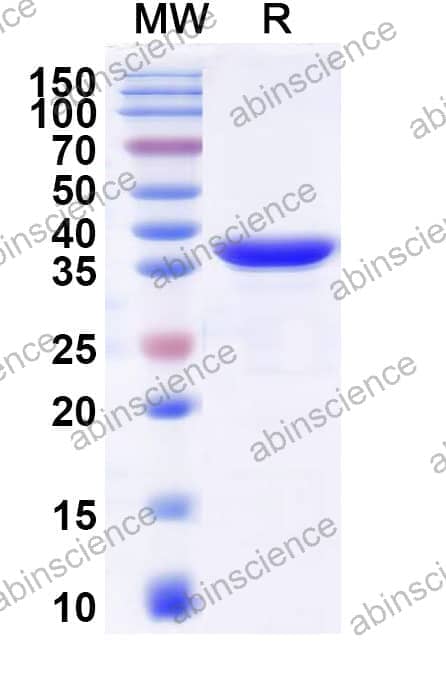 Recombinant Influenza D virus (Flu D) HE Protein, C-His