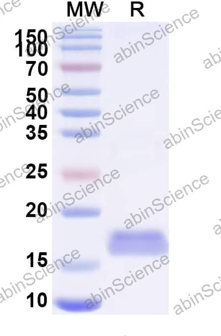 Anti-MERS-CoV RBD Nanobody (VHH-55)