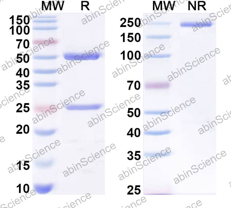 Anti-Testosterone Antibody (5F2)