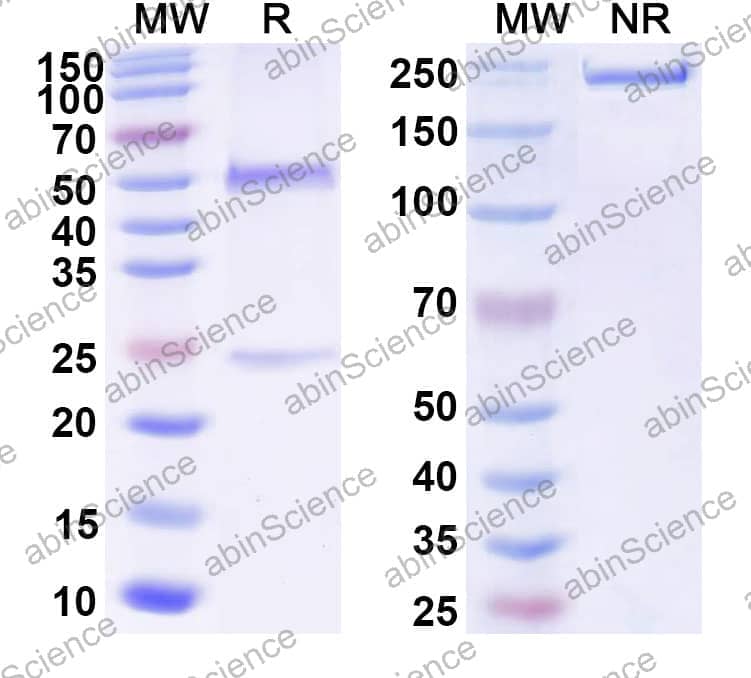 Anti-Human GFAP Antibody (N206B/9R)
