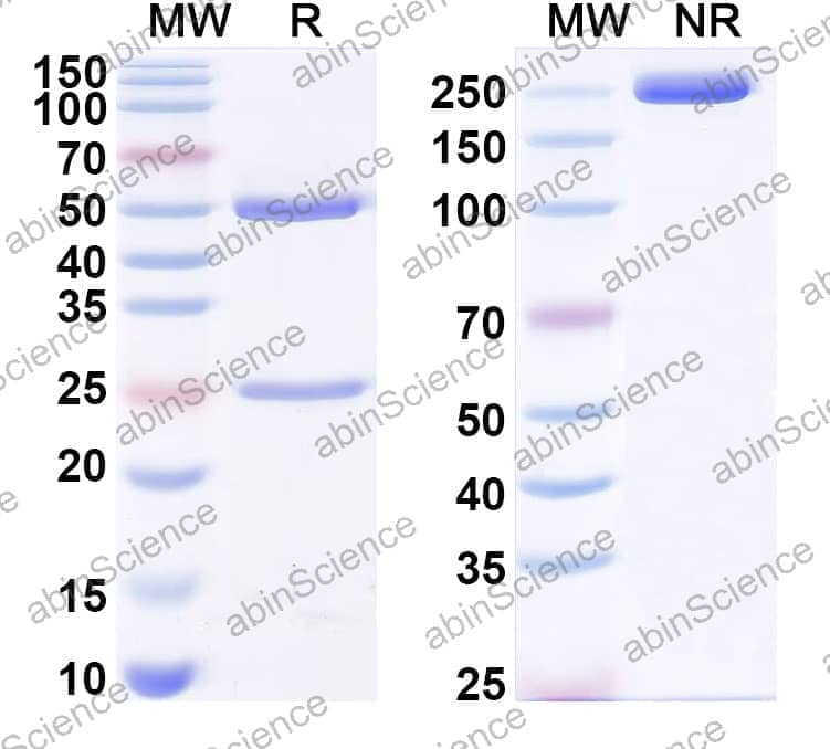 Anti-Human GFAP Antibody (H8/E9)