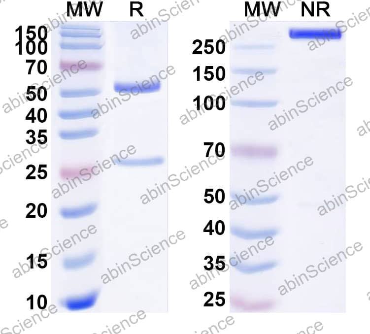 Anti-Oxidized Phospholipid Antibody (E06)
