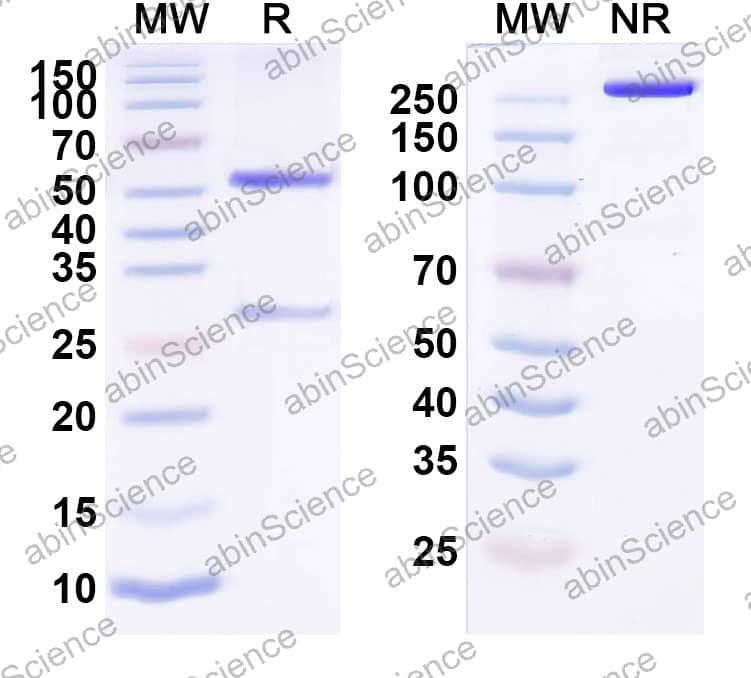 Anti-Cardiolipin Antibody (SAA2403)