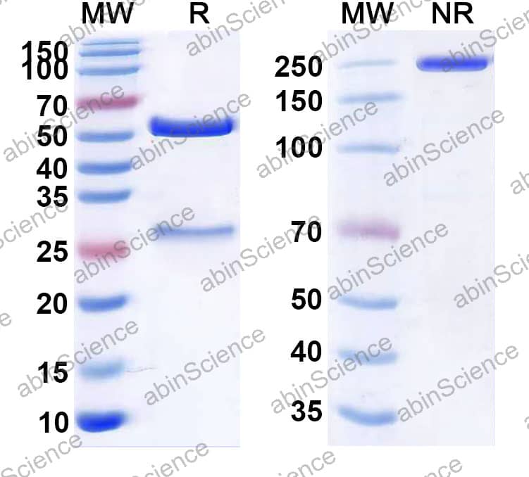 Anti-Cardiolipin Antibody (SAA2404)