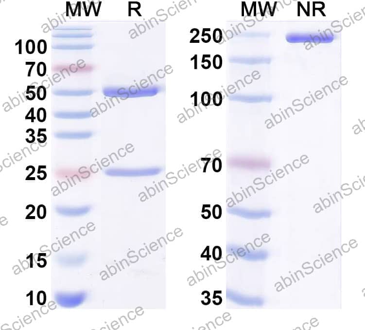 Anti-α-Gal Epitope (Galα1-3Galβ1-4GlcNAc-R) Antibody (B1H12)
