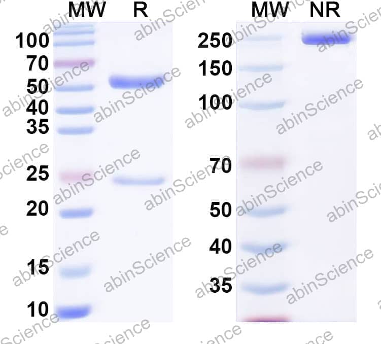 Anti-α-Gal Epitope (Galα1-3Galβ1-4GlcNAc-R) Antibody (P19)