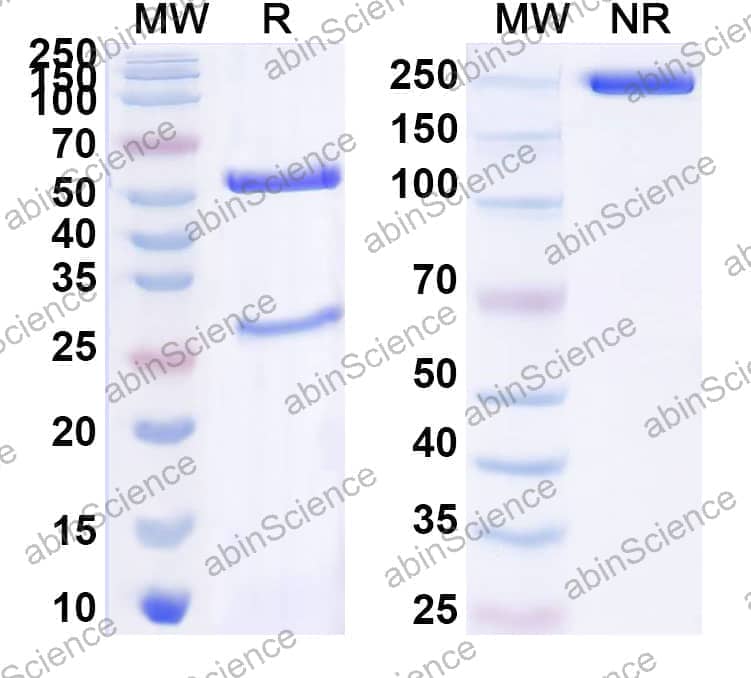 Anti-Porphyrin Antibody (14H7)