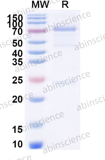Anti-Ganglioside GM1 mIgM Antibody (WO1)