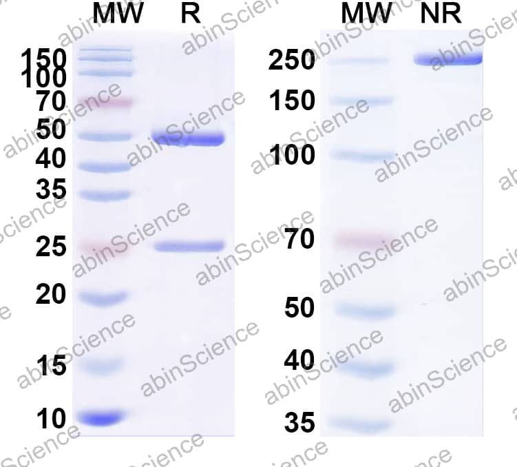 Anti-Ganglioside GM1 Antibody (SAA2528)