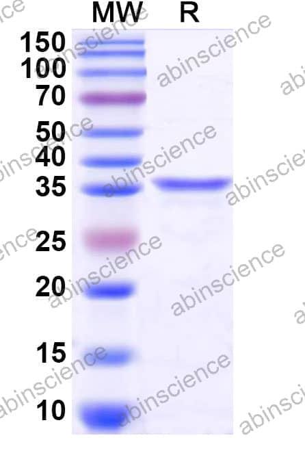 Recombinant Zebrafish Uricase/Uox Protein, N-His