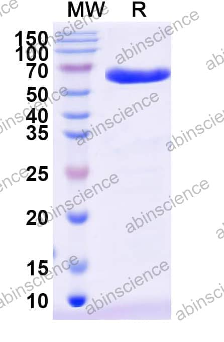 Recombinant Honeybee Api m 11/MRJP1 Protein, N-His-SUMO