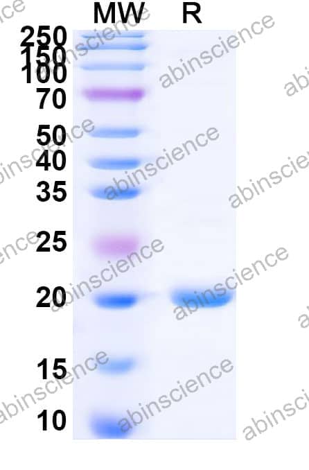 Recombinant Zebrafish IL1b Protein, N-His