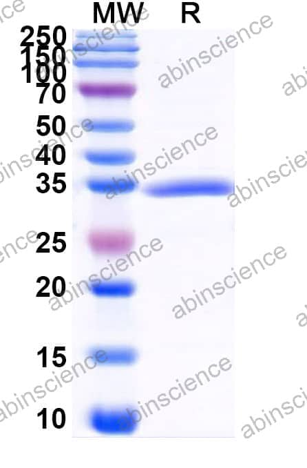 Recombinant Zebrafish slc2a10 Protein, N-GST & C-His