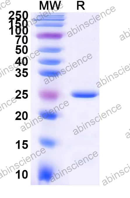 Recombinant Zebrafish CYP1A Protein, N-His