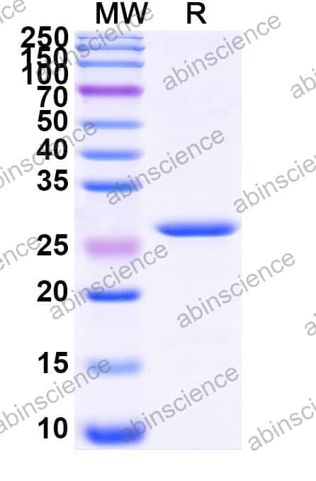 Recombinant Zebrafish cyp7a1 Protein, N-His