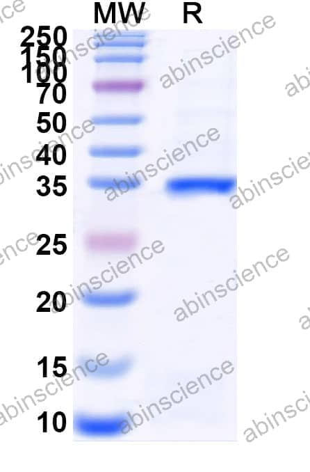 Recombinant Zebrafish foxo3a Protein, N-GST & C-His