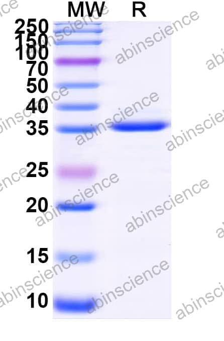 Recombinant Zebrafish sox9b Protein, N-GST & C-His