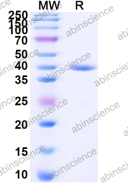 Recombinant Zebrafish bmp7a Protein, N-GST & C-His