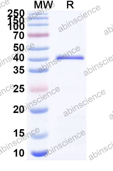 Recombinant Zebrafish prkab1a Protein, N-GST & C-His