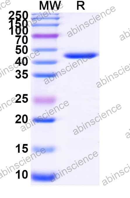 Recombinant Zebrafish mcf2lb Protein, N-GST & C-His
