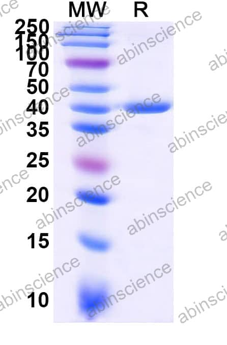Recombinant Zebrafish bcl2b Protein, N-GST & C-His
