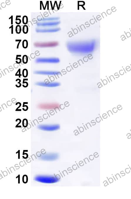 Recombinant Tupaia chinensis CD279/PDCD1/PD1 Protein, C-Fc