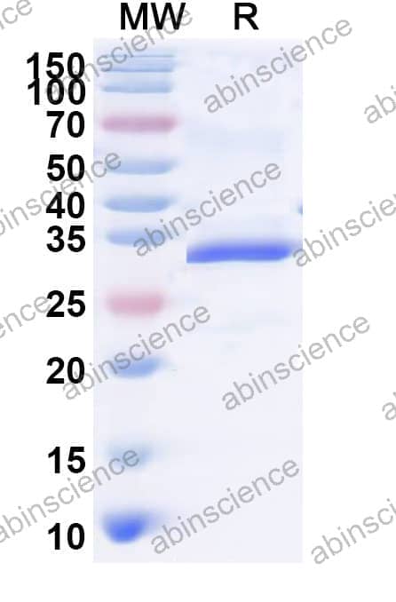 Recombinant Tupaia chinensis CD20/MS4A1 Protein, N-GST & C-His